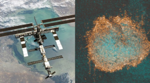 Composite image: the International Space Station and a closeup of diffuse midline glioma cells. Credit: public domain / NASA; Elisa Izquierdo / ICR